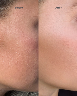 Flawless Face Oil