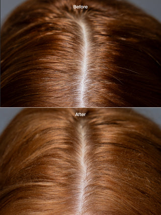 Healthy Hair Dry Shampoo