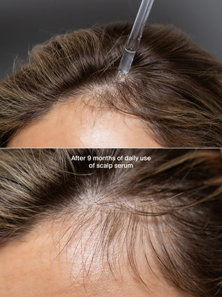 Treat & Extend Bundle